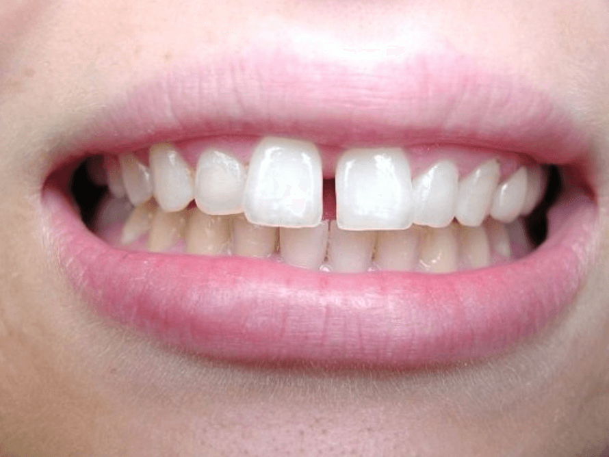 Ngành Kỹ thuật phục hình răng là học gì? Điểm chuẩn và các trường đào tạo