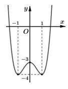 Đồ thị hàm số g(x) = f(|x - 2|) + 1